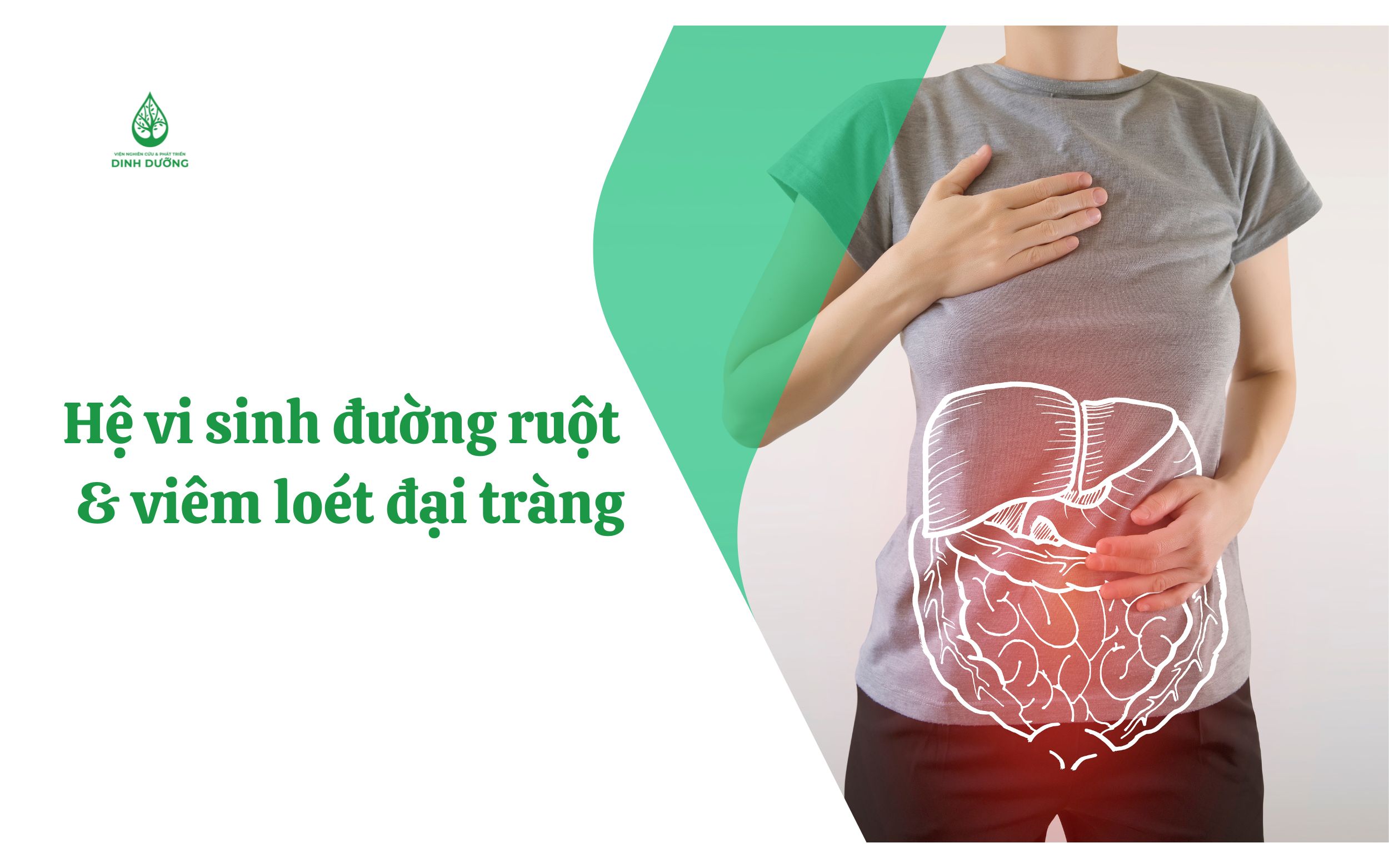Hệ vi sinh đường ruột và viêm loét đại tràng