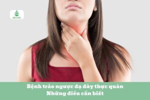 Bệnh trào ngược dạ dày thực quản Những điều cần biết